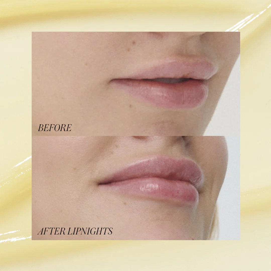 Liplights - Overnight Lip Mask - Image 4
