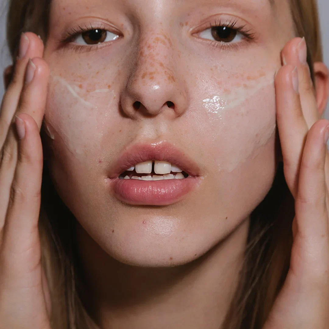 Hydra-Derm Balancing Fluid 'ACNE' - Image 3