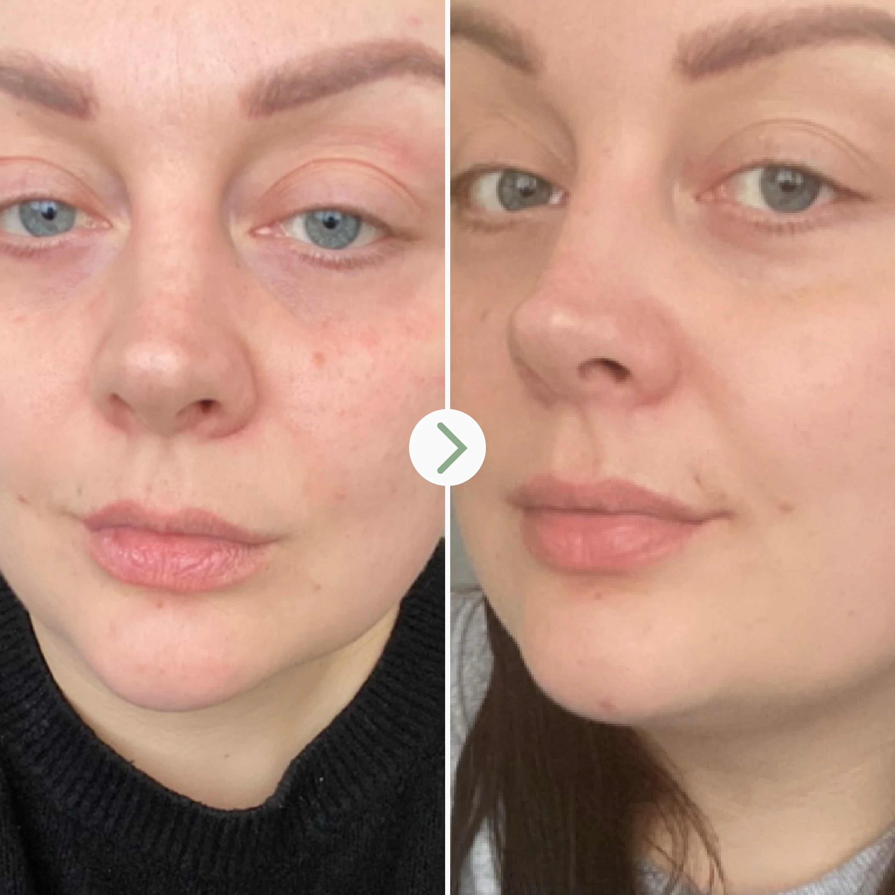 Rosehip Bioregenerate Face Oil - Image 4