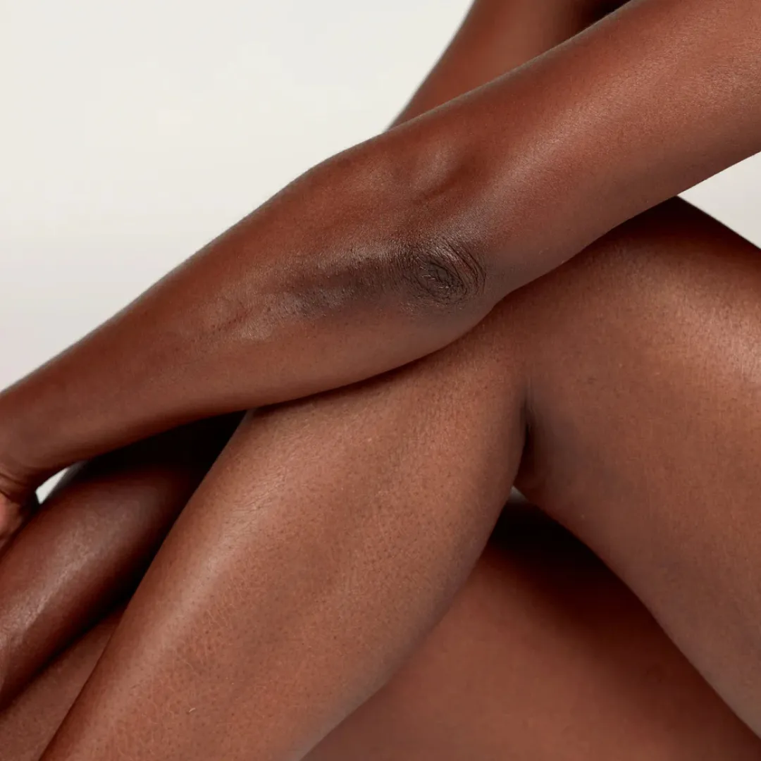 The Gemini™ - Stretch Mark Dual System - Image 3